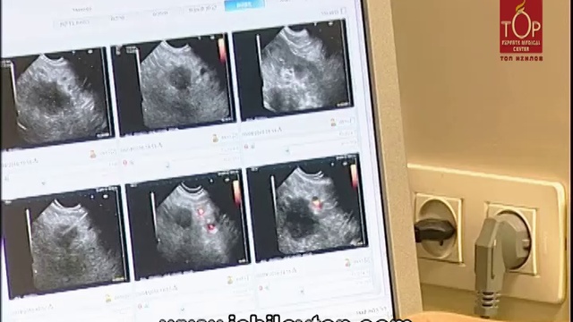 Гастроэнтерология в Израиле