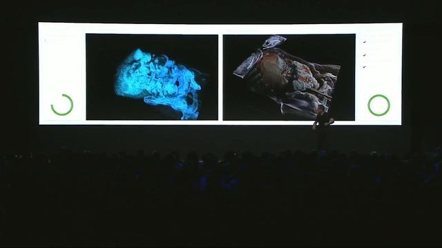 Nvidia Clara смотреть онлайн