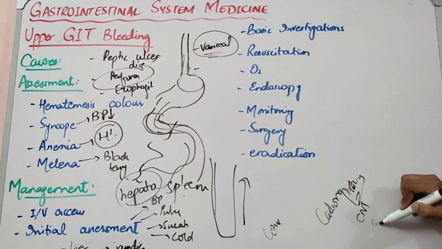 GIT MEDICINE lecture 1 UPPER GIT BLEDDING all important points in simplest way смотреть онлайн