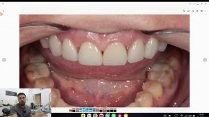 СТОМБУДНИ#28 КЕРАМИКА КАК ПЛАСТМАССА