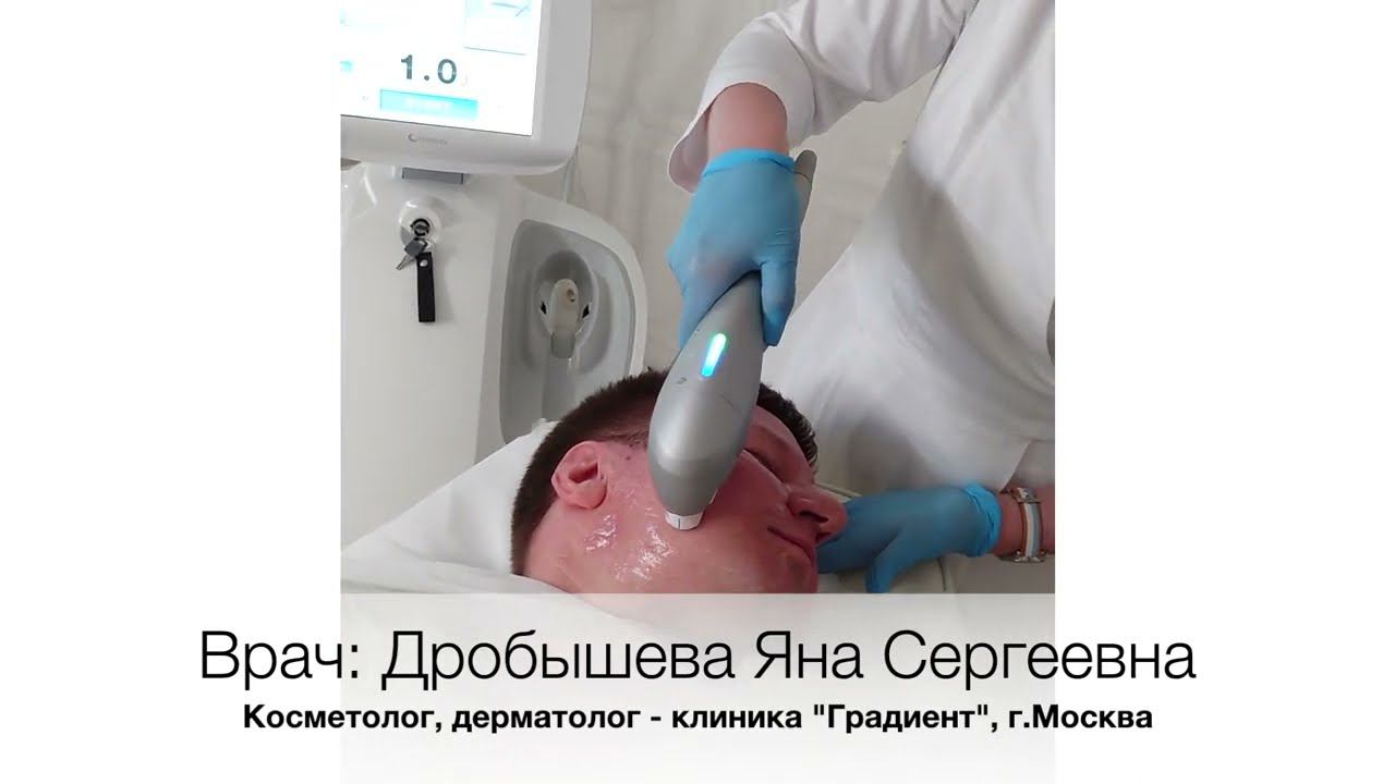 Коррекция овала лица: ULTRAFORMER III и инъекции смотреть онлайн