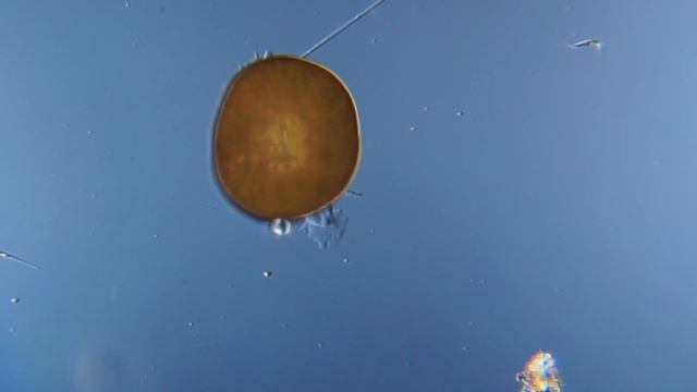Панцирная амеба под микроскопом смотреть онлайн