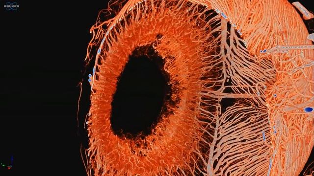 Micro-CT Of Eye Vasculature