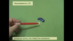 10  Неисправность слухового аппарата