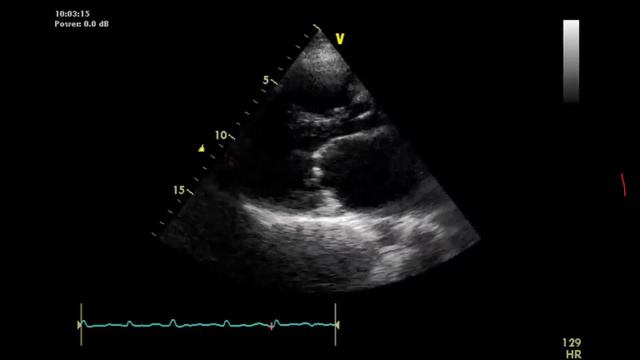 ГиП занятие 7 - болезни митрального клапана