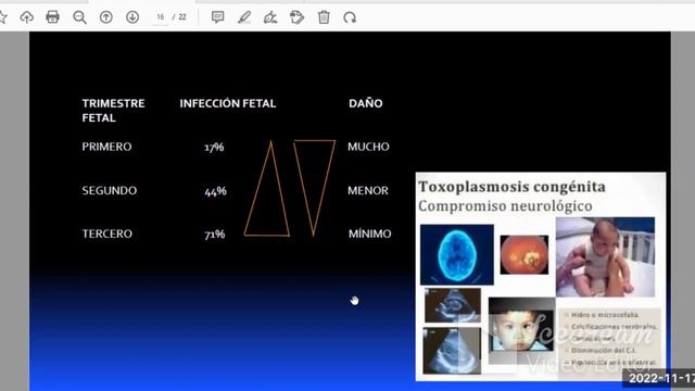 Parasitología - Toxoplasmosis – Toxocarosis - sem 13 URP смотреть онлайн