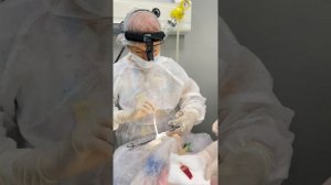 Иванова Н.А._удаление миндалин (тонзилотомия)