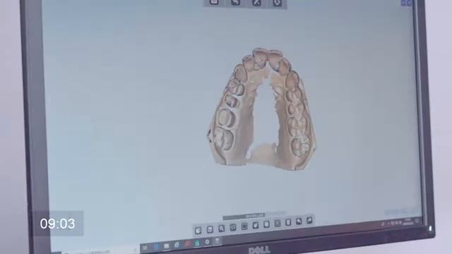 SHINING3D AutoScan DS EX Pro Dental 3D Scanner_EN http://дентальный-сканер.рф смотреть онлайн