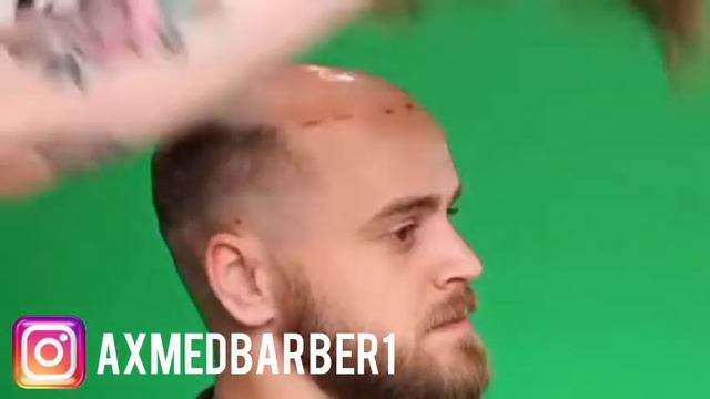 Мужские парики. Система волос. Интеграция волос. Алопеция. Муи сар часпондан. Казахстан. Таджикиста смотреть онлайн