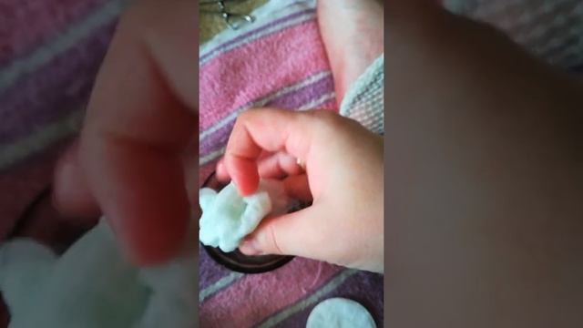 Что делать если укусил кот? смотреть онлайн