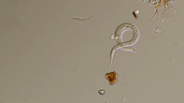Наглядная микробиология #15 Нематоды (Nematode) смотреть онлайн