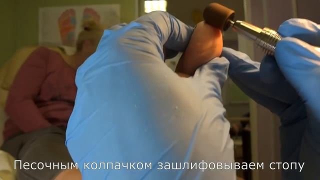 Аппаратный педикюр