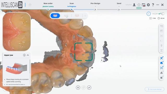 Intelliscan 3D Live Full Arch Scan смотреть онлайн