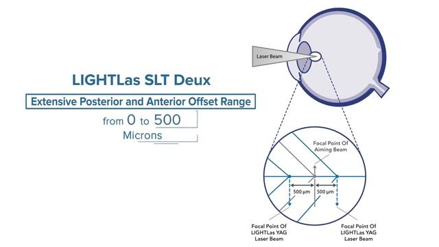 Комбинированная лазерная система (YAG+SLT) SeLecTor Deux смотреть онлайн