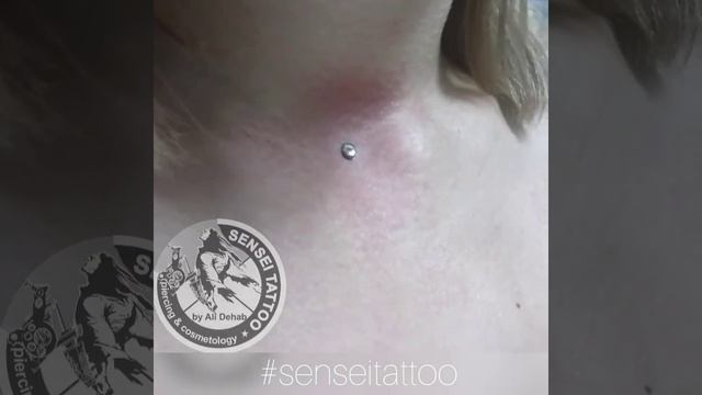 Качественно и без последствий установить микродермал в Днепре смотреть онлайн