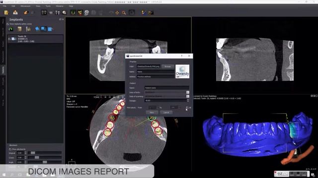 How to create a Dicom images report in Quickvision 3D смотреть онлайн