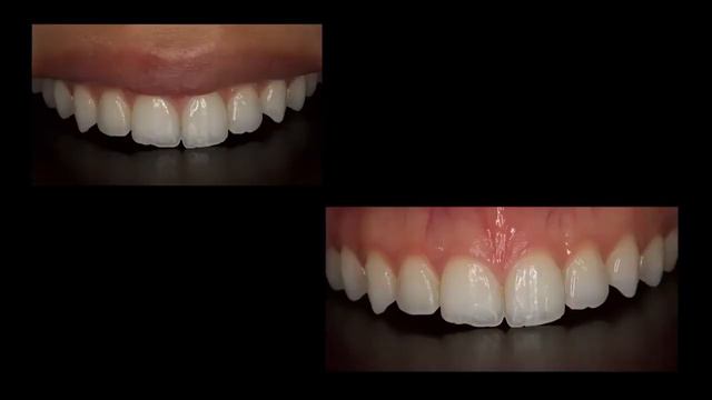 Практическая дентальная фотография: основы