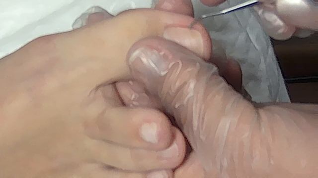 Как правильно вырезать вросший ноготь в домашних условиях: совет мастера педикюра.