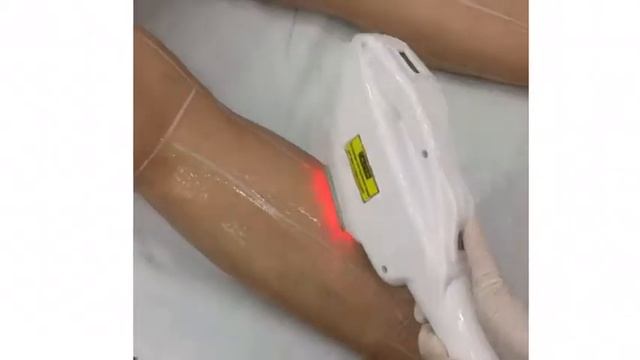 IPL shr in Berlin смотреть онлайн