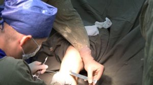 Травматология и ортопедия. Разрыв передней крестообразной связки.