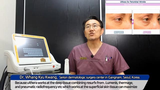 ulthera lifting improving wrinkle, and skin tightening. смотреть онлайн