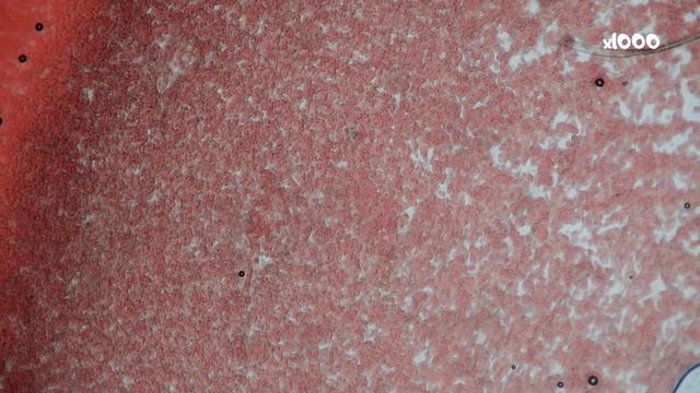 Кровь человека под микроскопом смотреть онлайн