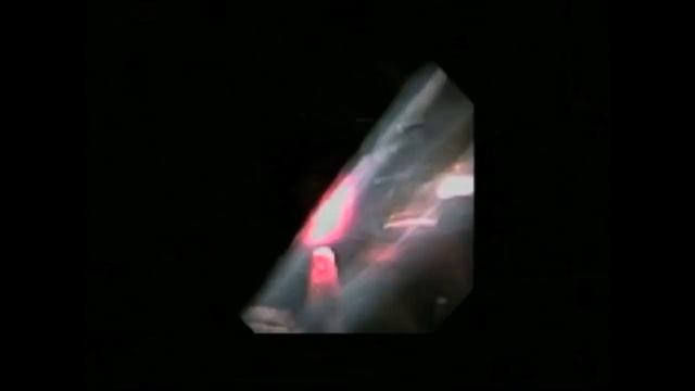 Accordion URS Laser Durability at 20W смотреть онлайн