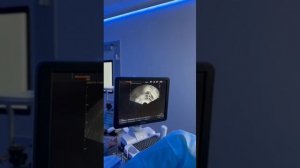 Пункция фолликулов в программе ЭКО ПО КВОТЕ