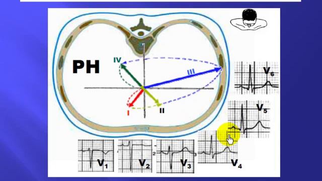 1- CARDIOLOGÍA 1 смотреть онлайн