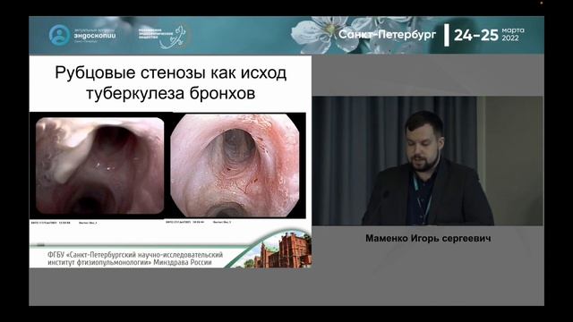 Маменко ИС Tb or not Tb узнай врага в лицо смотреть онлайн