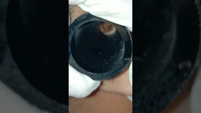 Examination of Ear Canal with Ear Speculum Part 1.2 Dr Mohan Bansal смотреть онлайн