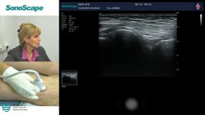 Мастер-класс на аппарате SonoScape S40Exp. Лектор: Салтыкова В.Г.