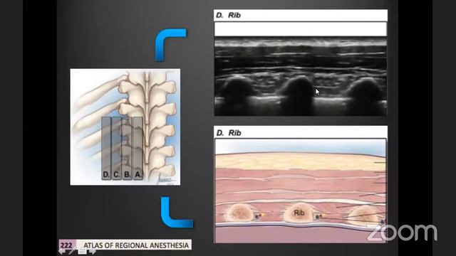 Retos de Analgesia en cirugía Cardiotorácica, Dr. Diego Javier Peña смотреть онлайн