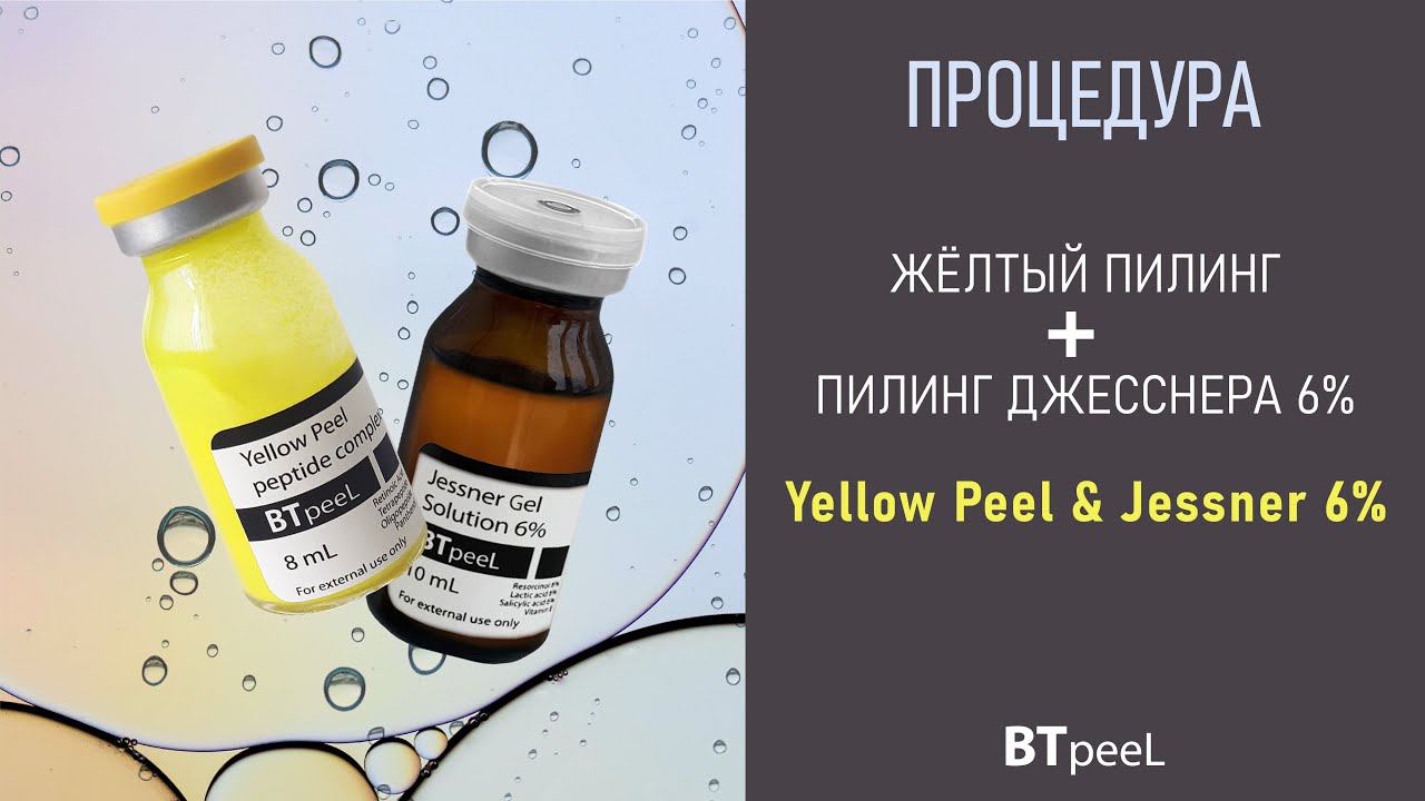 Процедура Жёлтый пилинг + Пилинг Джесснера 6% смотреть онлайн