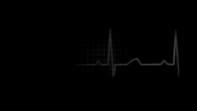 Heart Flatline смотреть онлайн