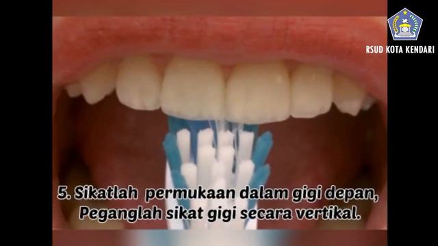 EDUKASI CARA MENYIKAT GIGI DENGAN BAIK DAN BENAR (POLI GIGI) смотреть онлайн