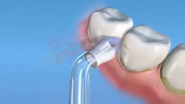 Насадка ирригатора для имплантатов смотреть онлайн