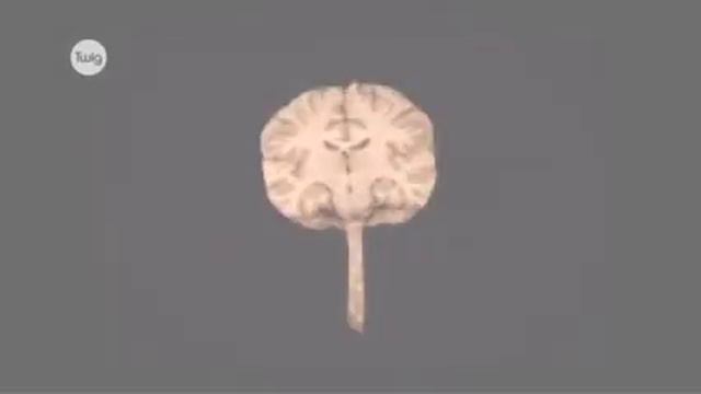 Ознакомление с мозгом смотреть онлайн