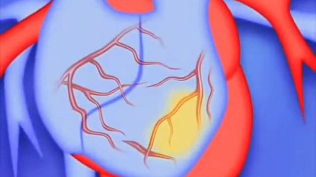 Красный рис для здоровья смотреть онлайн