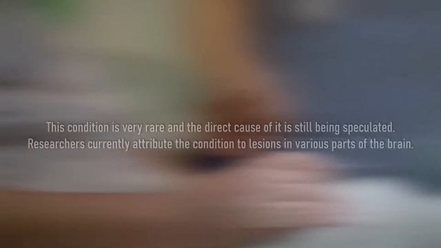 Alien Hand Syndrome - A First Person POV смотреть онлайн