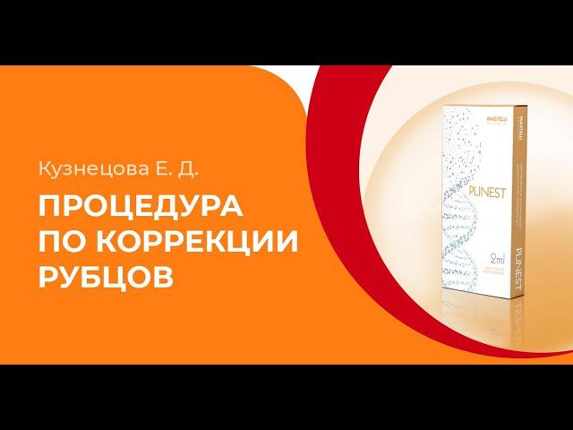 Процедура по коррекции рубцов препаратом PLINEST смотреть онлайн