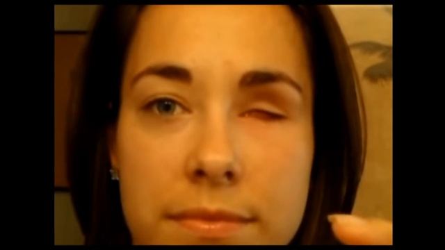 Вытаскивает ГЛАЗ! Pulls The Eye!