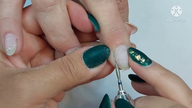 ОНИХОЛИЗИС!!! ТАКОГО В МОЕЙ ПРАКТИКЕ НЕ БЫЛО!!! ПРОТЕЗИРОВАНИЕ НОГТЕЙ!!! смотреть онлайн