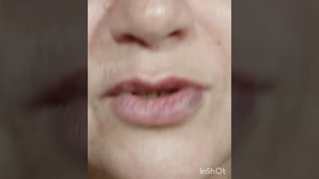 Решила подколоть губы Хотелось чуть-чуть Косметолог меня поняла смотреть онлайн