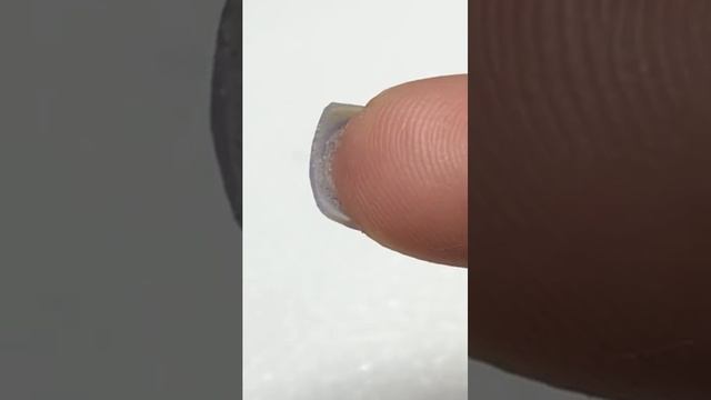 ОПУХОЛЬ ПОД НОГТЕМ ? смотреть онлайн