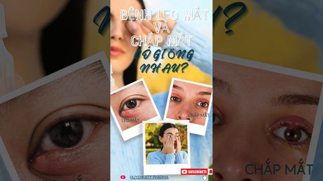 BỆNH LẸO MẮT VÀ CHẮP MẮT CÓ GIỐNG NHAU? смотреть онлайн