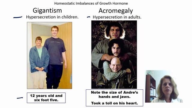 Ant Pit GH and MSH смотреть онлайн