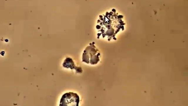 Bacteria Attacking White Blood Cells