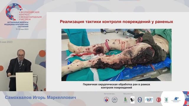 Огнестрельная травма Самохвалов И.М.