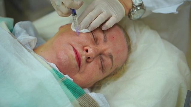 Коллагенотерапия препаратом Linerase.mp4 смотреть онлайн